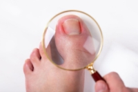 What to Do With an Ingrown Toenail